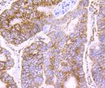 PDK2 Antibody in Immunohistochemistry (Paraffin) (IHC (P))