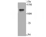 USP7 Antibody in Western Blot (WB)