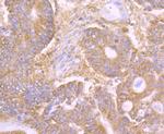 CD205 Antibody in Immunohistochemistry (Paraffin) (IHC (P))