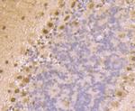 PSMA1 Antibody in Immunohistochemistry (Paraffin) (IHC (P))