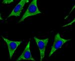 CYP17A1 Antibody in Immunocytochemistry (ICC/IF)