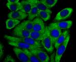 CYP17A1 Antibody in Immunocytochemistry (ICC/IF)