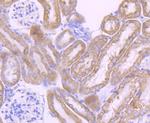 CYP17A1 Antibody in Immunohistochemistry (Paraffin) (IHC (P))