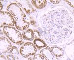 CYP17A1 Antibody in Immunohistochemistry (Paraffin) (IHC (P))