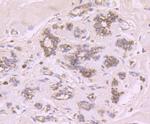 CYP17A1 Antibody in Immunohistochemistry (Paraffin) (IHC (P))