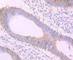 FZD8 Antibody in Immunohistochemistry (Paraffin) (IHC (P))