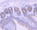 CPS1 Antibody in Immunohistochemistry (Paraffin) (IHC (P))