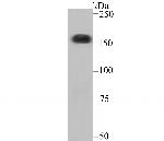 CPS1 Antibody in Western Blot (WB)