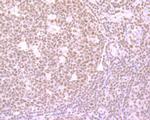 SRSF1 Antibody in Immunohistochemistry (Paraffin) (IHC (P))