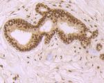 SRSF1 Antibody in Immunohistochemistry (Paraffin) (IHC (P))