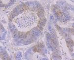 RRM1 Antibody in Immunohistochemistry (Paraffin) (IHC (P))