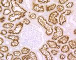 CUBN Antibody in Immunohistochemistry (Paraffin) (IHC (P))