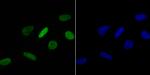 H4K16ac Antibody in Immunocytochemistry (ICC/IF)