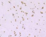 H4K16ac Antibody in Immunohistochemistry (Paraffin) (IHC (P))