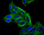 Arp3 Antibody in Immunocytochemistry (ICC/IF)