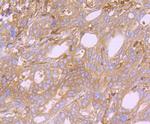 Arp3 Antibody in Immunohistochemistry (Paraffin) (IHC (P))