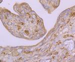 Arp3 Antibody in Immunohistochemistry (Paraffin) (IHC (P))