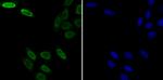 SNRPA Antibody in Immunocytochemistry (ICC/IF)