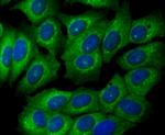 GPI Antibody in Immunocytochemistry (ICC/IF)