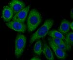 Syntrophin alpha-1 Antibody in Immunocytochemistry (ICC/IF)