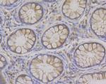 Syntrophin alpha-1 Antibody in Immunohistochemistry (Paraffin) (IHC (P))