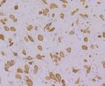 FBXO5 Antibody in Immunohistochemistry (Paraffin) (IHC (P))