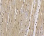 CENPC Antibody in Immunohistochemistry (Paraffin) (IHC (P))