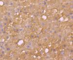 SULT2A1 Antibody in Immunohistochemistry (Paraffin) (IHC (P))