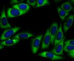 UQCRFS1 Antibody in Immunocytochemistry (ICC/IF)