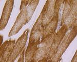 UQCRFS1 Antibody in Immunohistochemistry (Paraffin) (IHC (P))