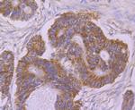 UQCRFS1 Antibody in Immunohistochemistry (Paraffin) (IHC (P))