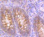 UQCRFS1 Antibody in Immunohistochemistry (Paraffin) (IHC (P))