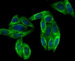 VAMP3 Antibody in Immunocytochemistry (ICC/IF)