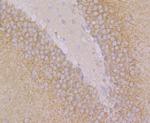 GEF-H1 Antibody in Immunohistochemistry (Paraffin) (IHC (P))