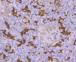 p53DINP1 Antibody in Immunohistochemistry (Paraffin) (IHC (P))