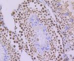 SF3B3 Antibody in Immunohistochemistry (Paraffin) (IHC (P))