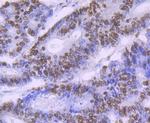 SF3B3 Antibody in Immunohistochemistry (Paraffin) (IHC (P))