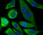 SOCS2 Antibody in Immunocytochemistry (ICC/IF)