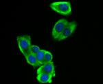 SOCS2 Antibody in Immunocytochemistry (ICC/IF)