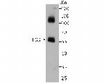 Fibrinogen gamma Antibody in Western Blot (WB)