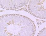 RANGAP1 Antibody in Immunohistochemistry (Paraffin) (IHC (P))