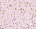 RANGAP1 Antibody in Immunohistochemistry (Paraffin) (IHC (P))