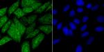 HIF1AN Antibody in Immunocytochemistry (ICC/IF)