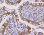 SENP1 Antibody in Immunohistochemistry (Paraffin) (IHC (P))