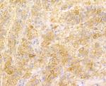 SENP1 Antibody in Immunohistochemistry (Paraffin) (IHC (P))