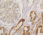 BAP31 Antibody in Immunohistochemistry (Paraffin) (IHC (P))