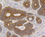 BAP31 Antibody in Immunohistochemistry (Paraffin) (IHC (P))