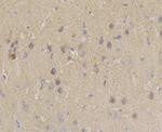 PIST Antibody in Immunohistochemistry (Paraffin) (IHC (P))