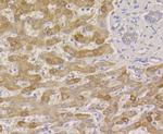 PIST Antibody in Immunohistochemistry (Paraffin) (IHC (P))