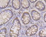 PIST Antibody in Immunohistochemistry (Paraffin) (IHC (P))